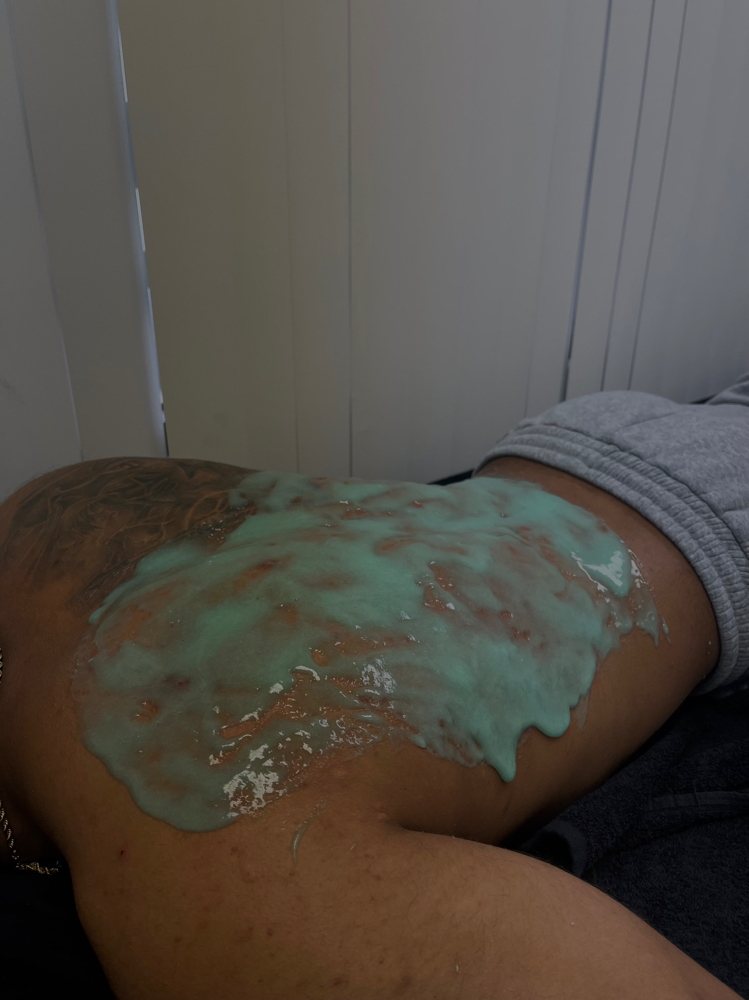 Back Facial