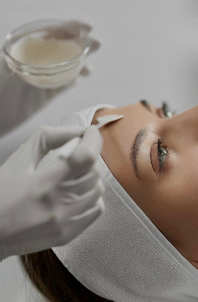 Chemical Peel