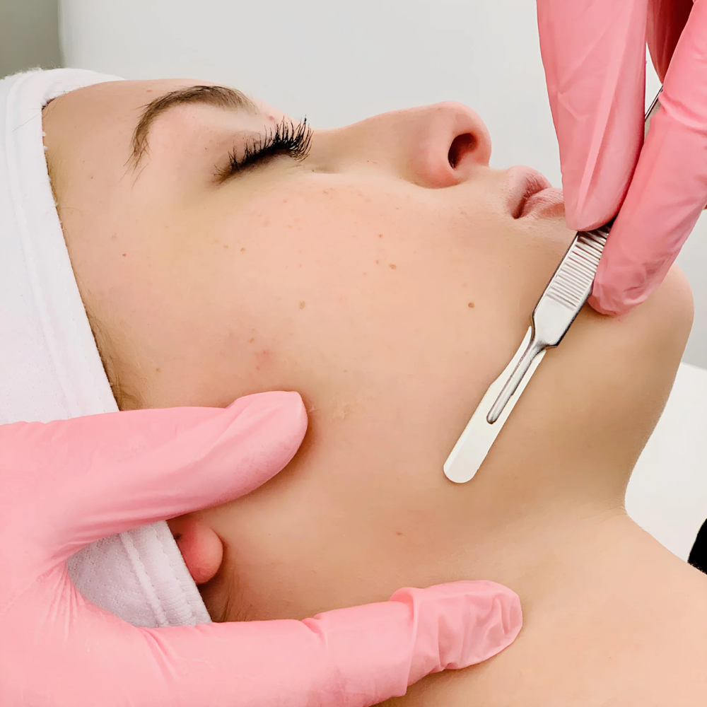 Dermaplaning Facial