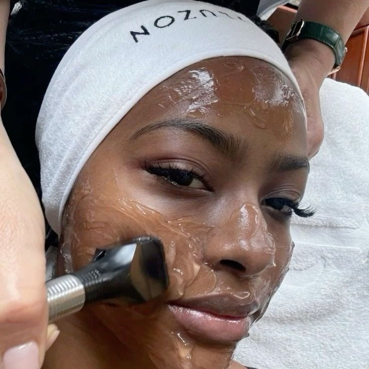 Radiofrequency Face Tightening at Luxe Royale Spa in Paramus, NJ