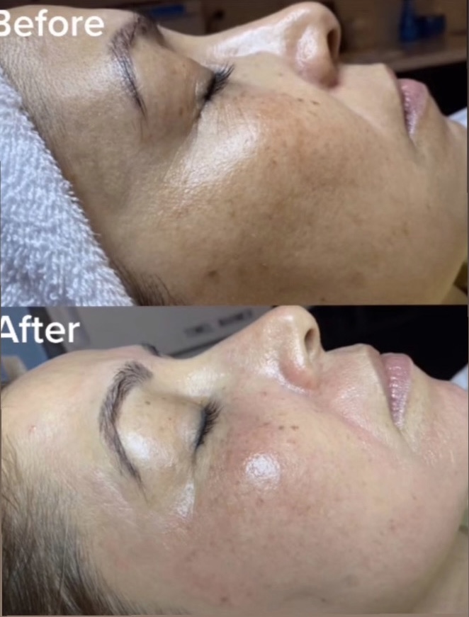 Glow Facial