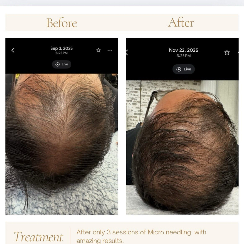 Hair Regrowth Services at Simply Hope Beauty Salon in Bladenboro, NC