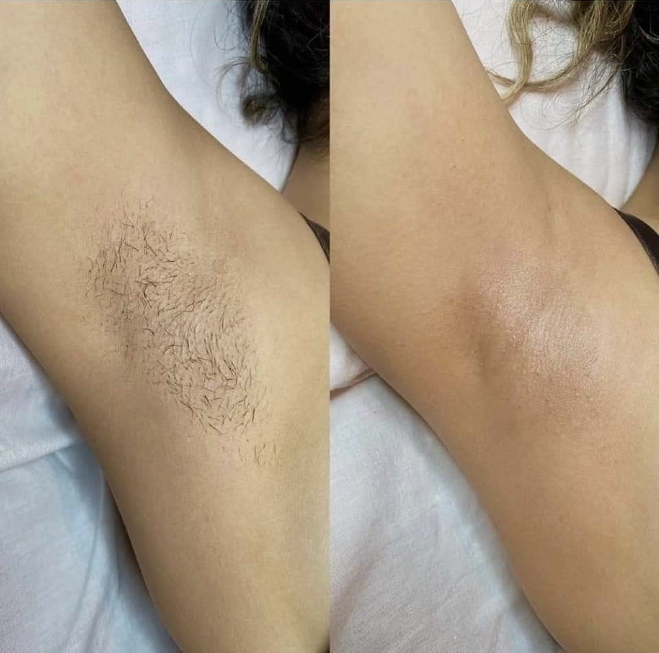 Underarm Wax