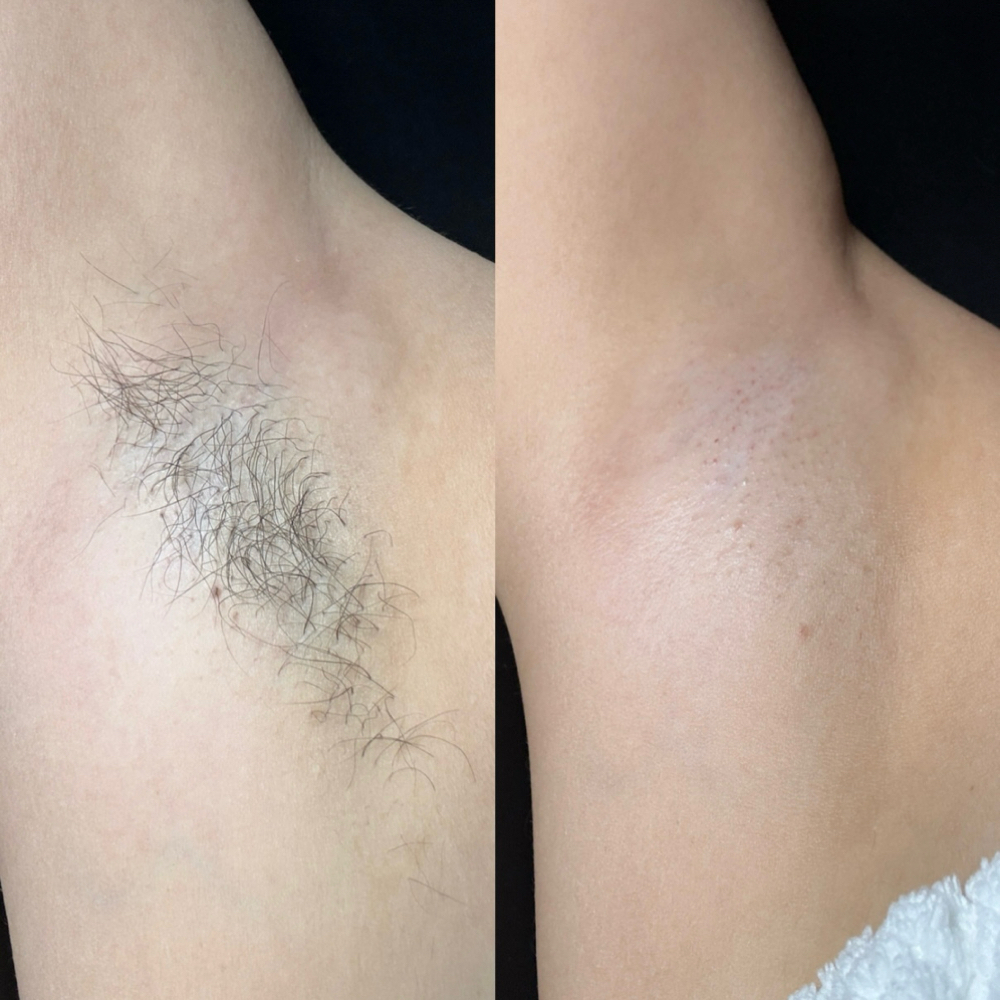 Underarm Wax at Bare Reflections Studio in Tulare, CA