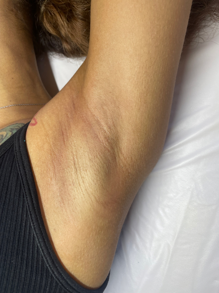 Underarm Wax