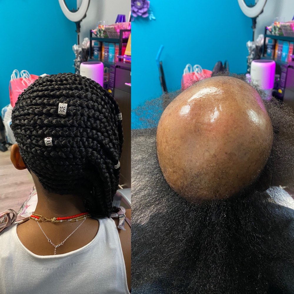 Alopecia Braid Style