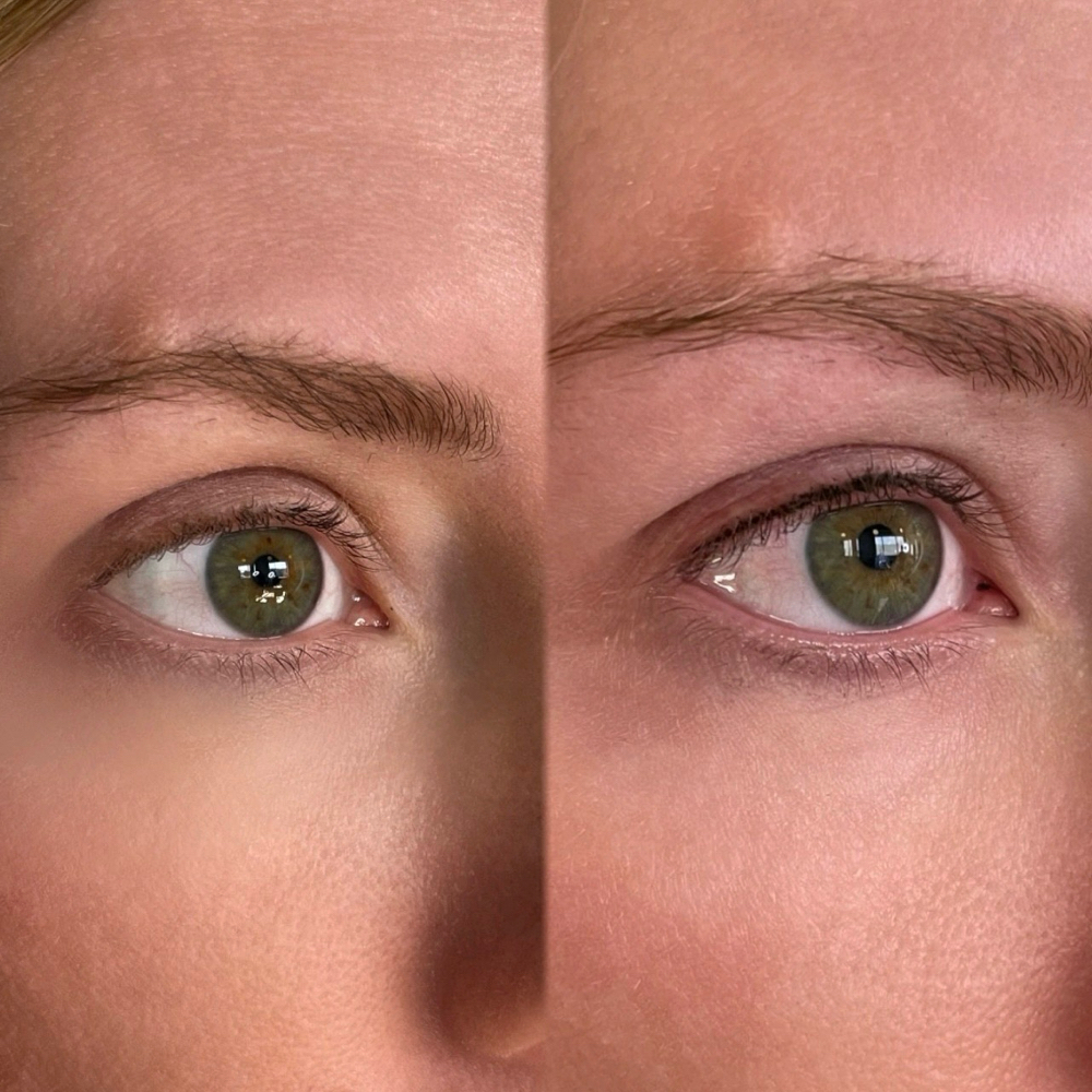 Lashline Enhancement