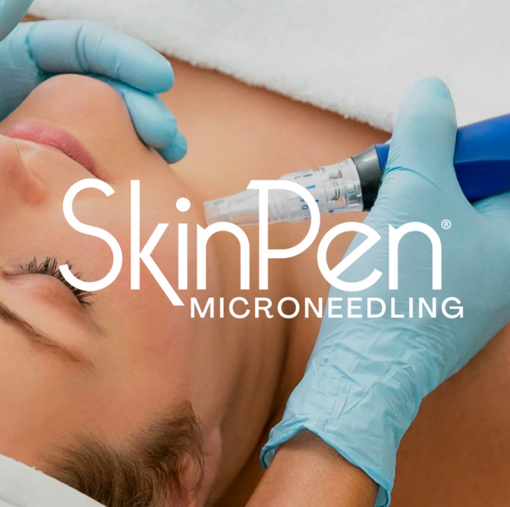 SkinPen microneedling at Beauty N Botox Medspa in Kingwood, TX