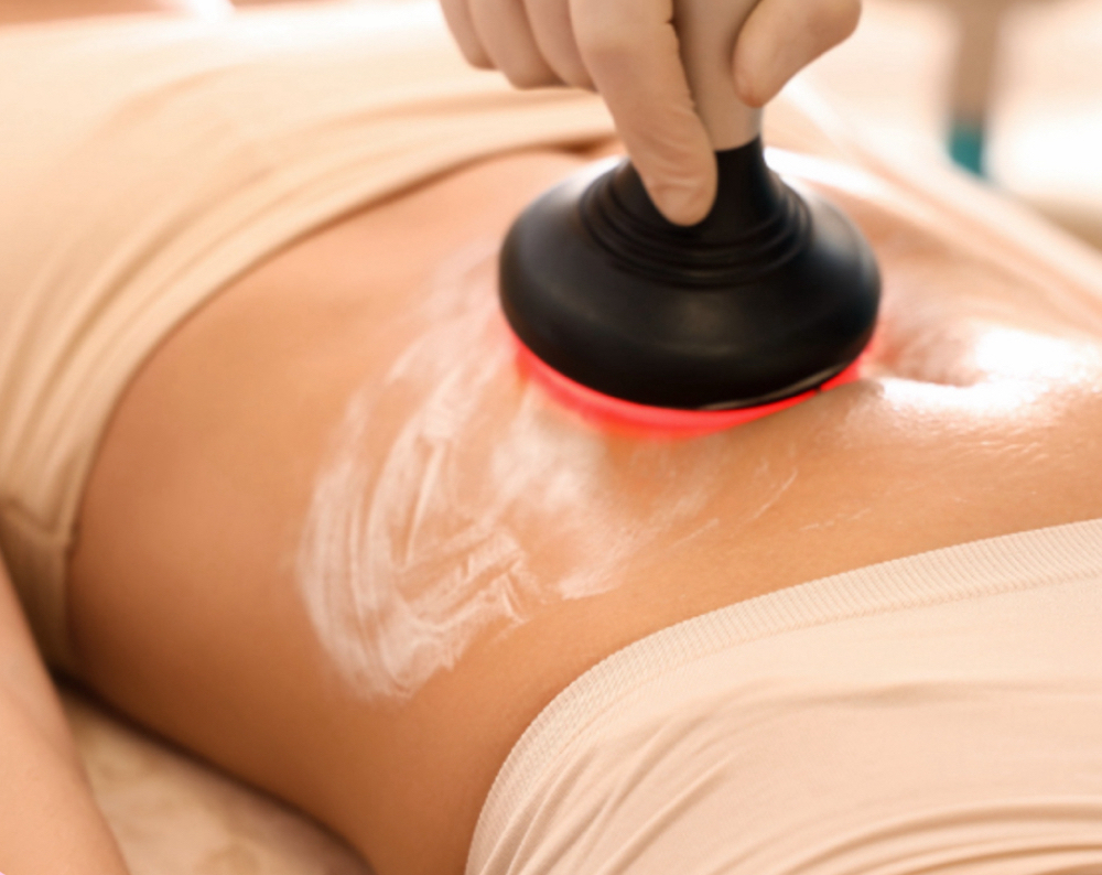 Cavitation