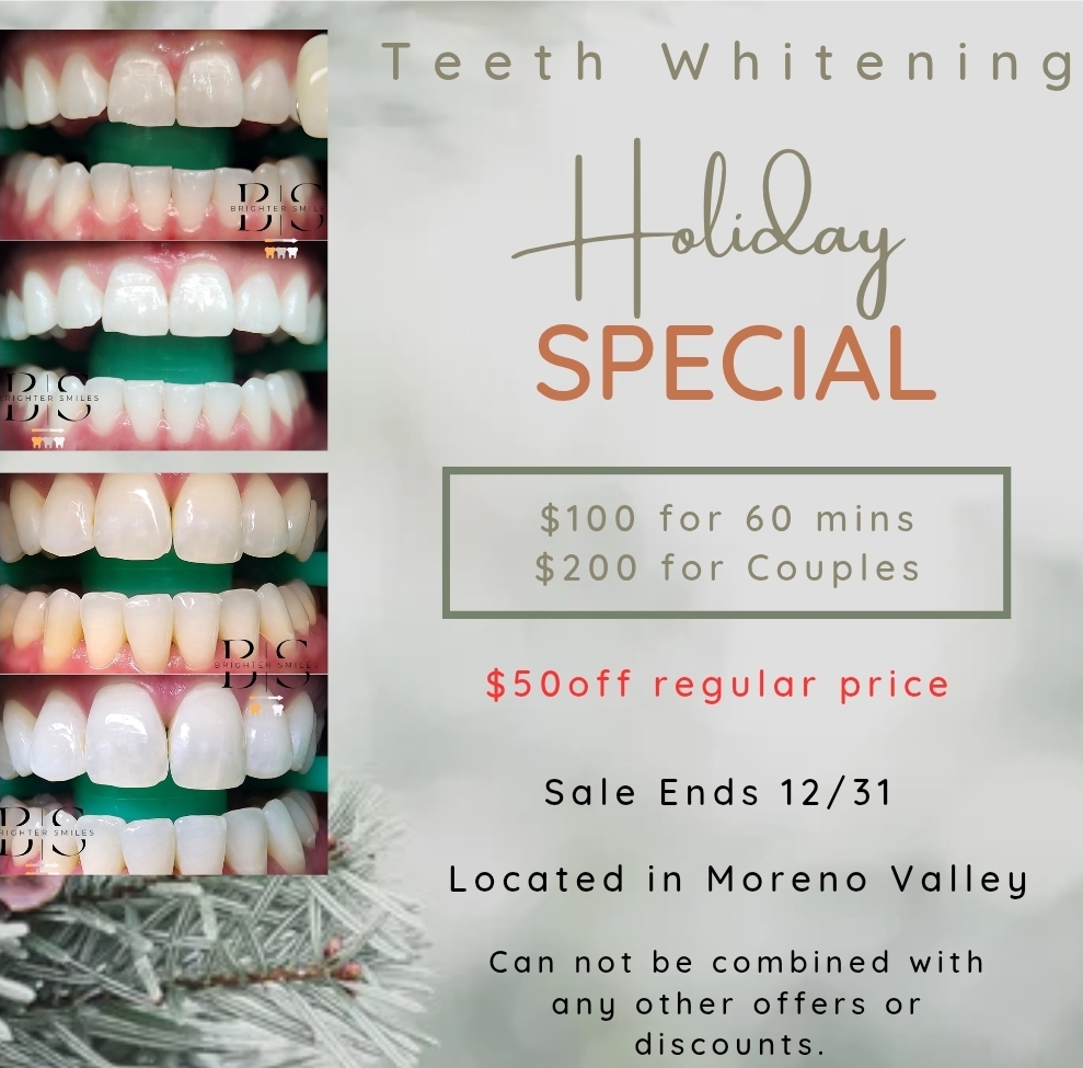 Teeth Whitening Holiday Special