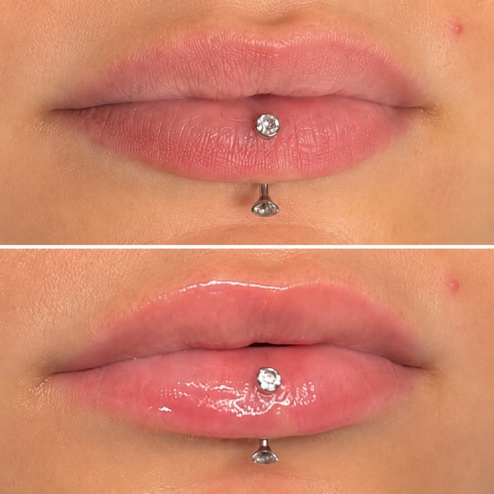 Hydragloss Lip Treatment at Zen Beauty Lounge in Stroudsburg, PA