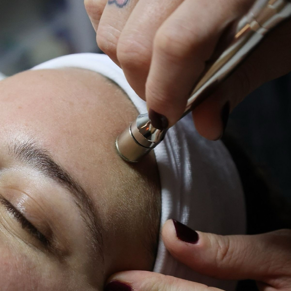 Microdermabrasion Add-On at Skintuition Skincare Boutique in Pewee Valley, KY