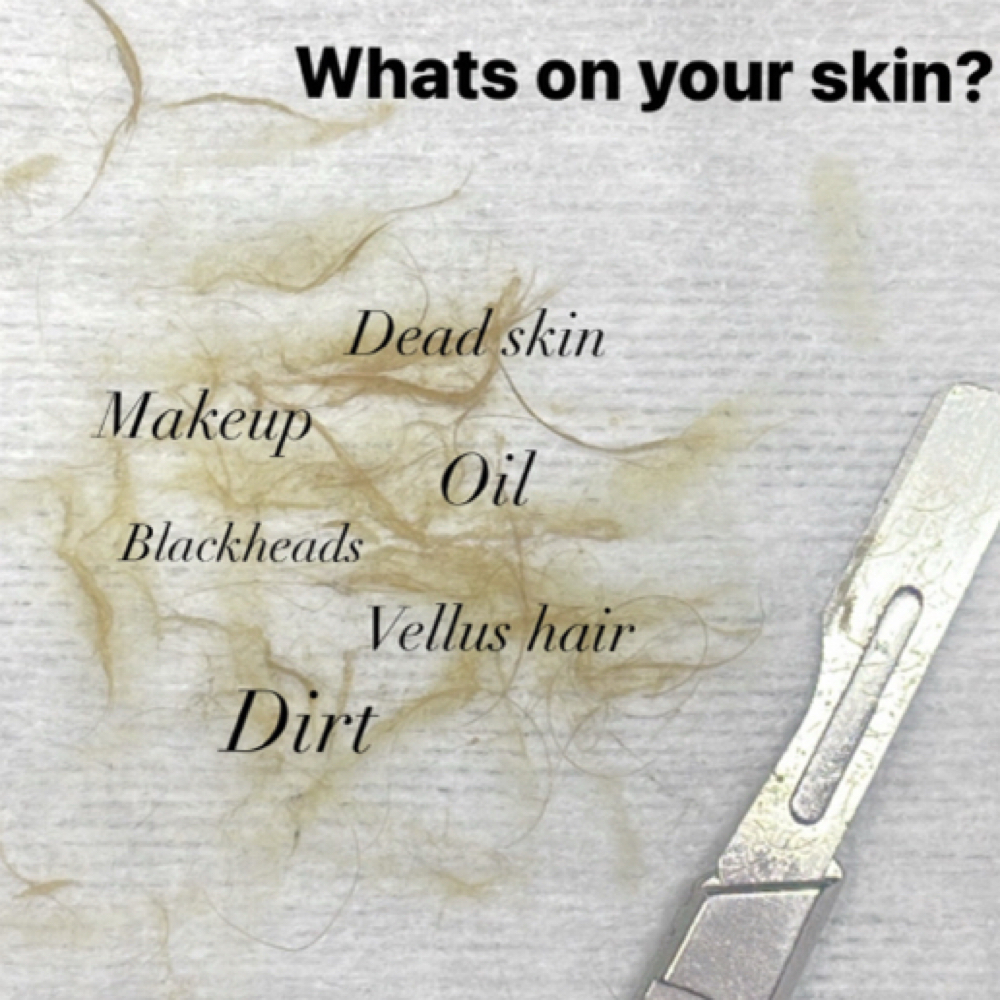 Dermaplaning Facial at Beauty By Randi in Farmington, MI