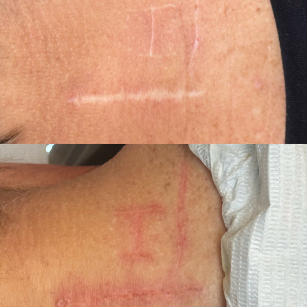Scar Camoflauge at Lyssie B. Artistry in Port Jervis, NY