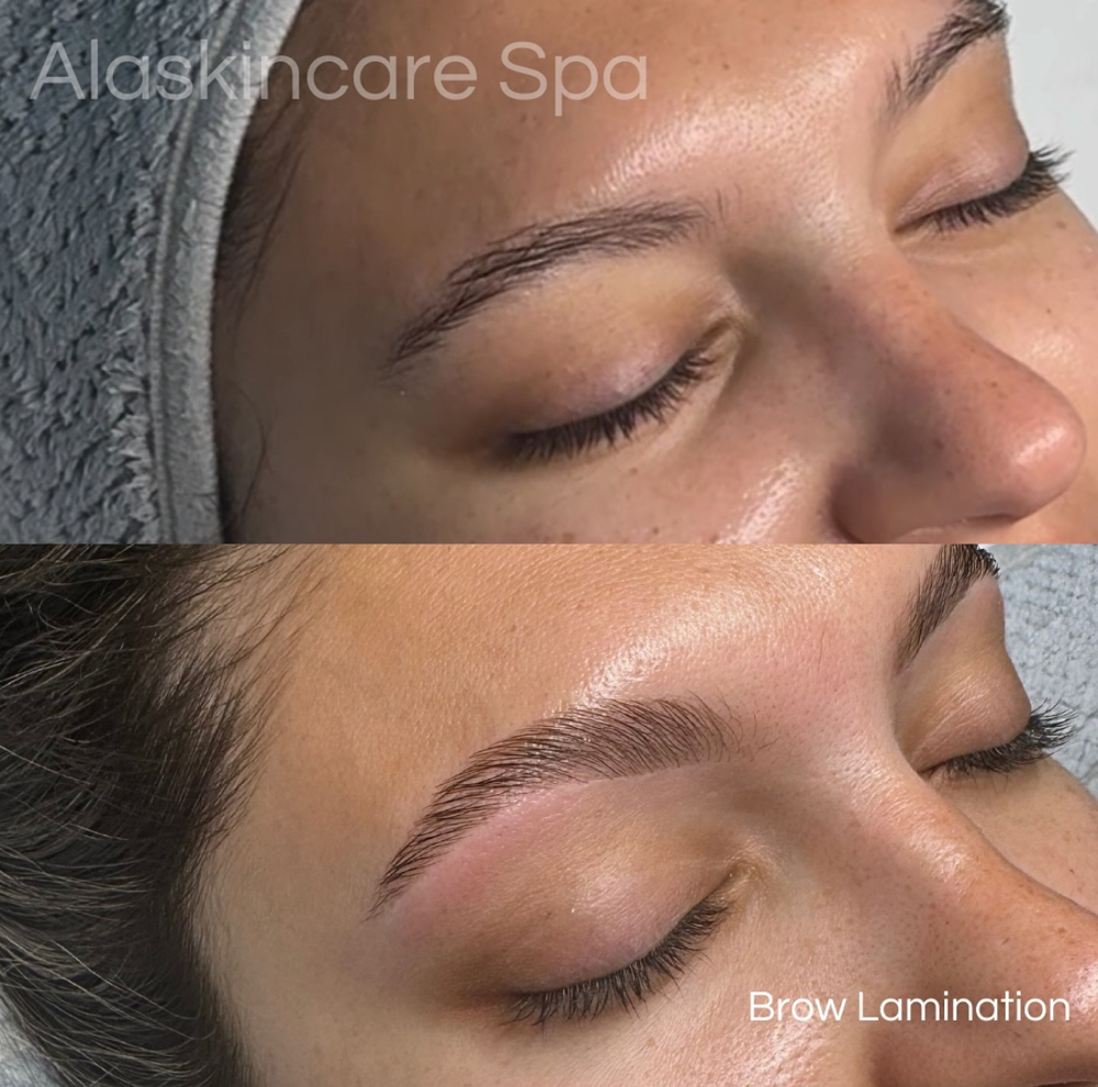 Brow Lamination