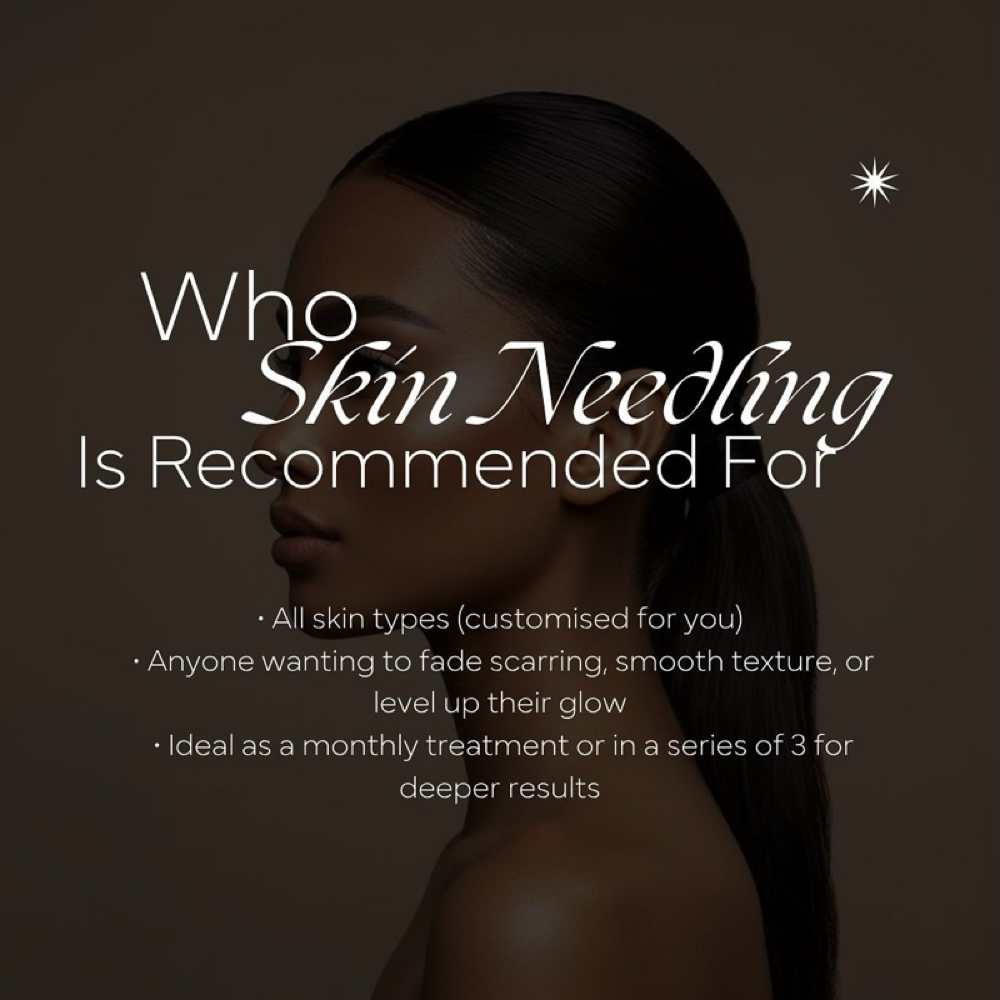 SKIN NEEDLING Rx