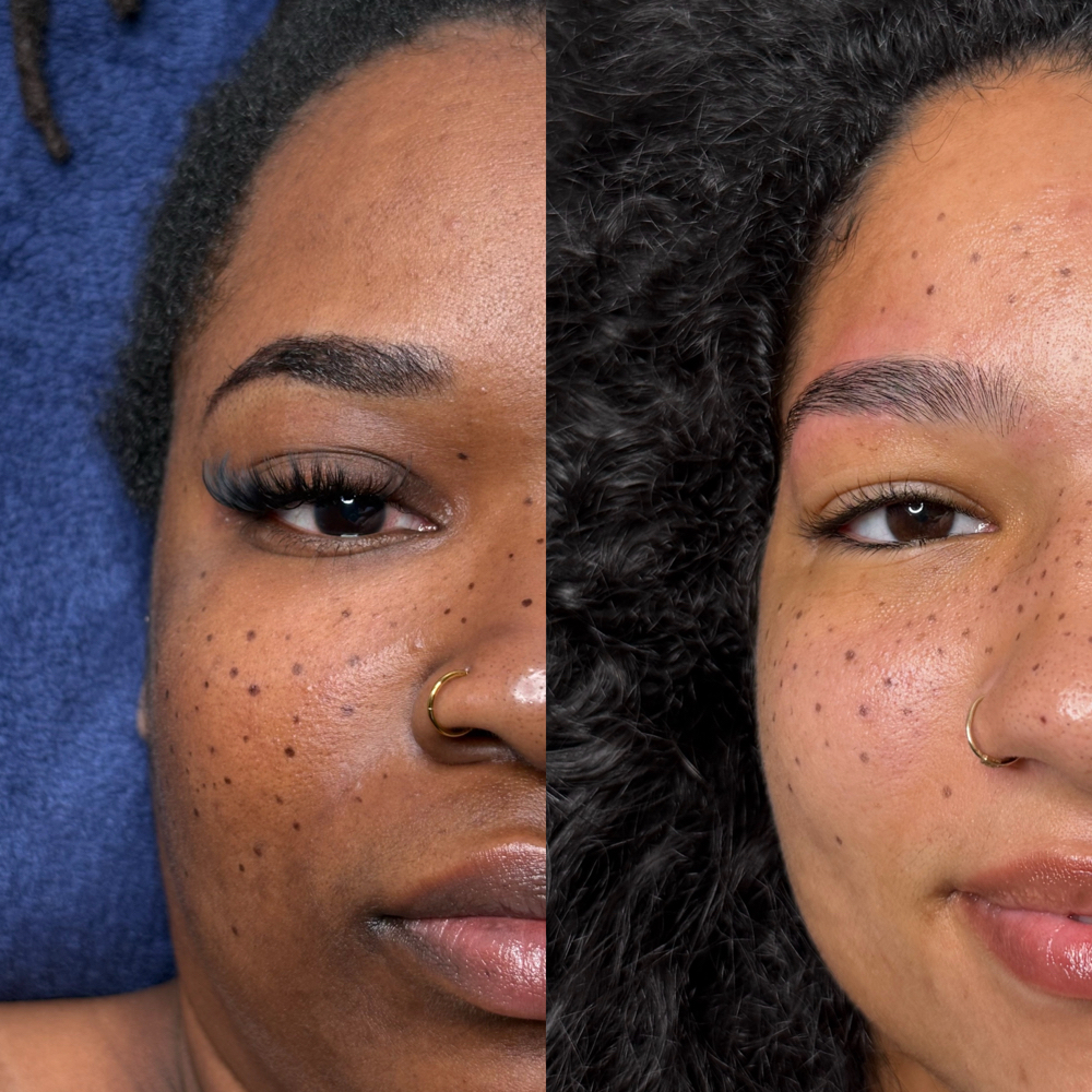 Henna Freckles + Add Ons at Mo Skin Beauty in Tampa, FL