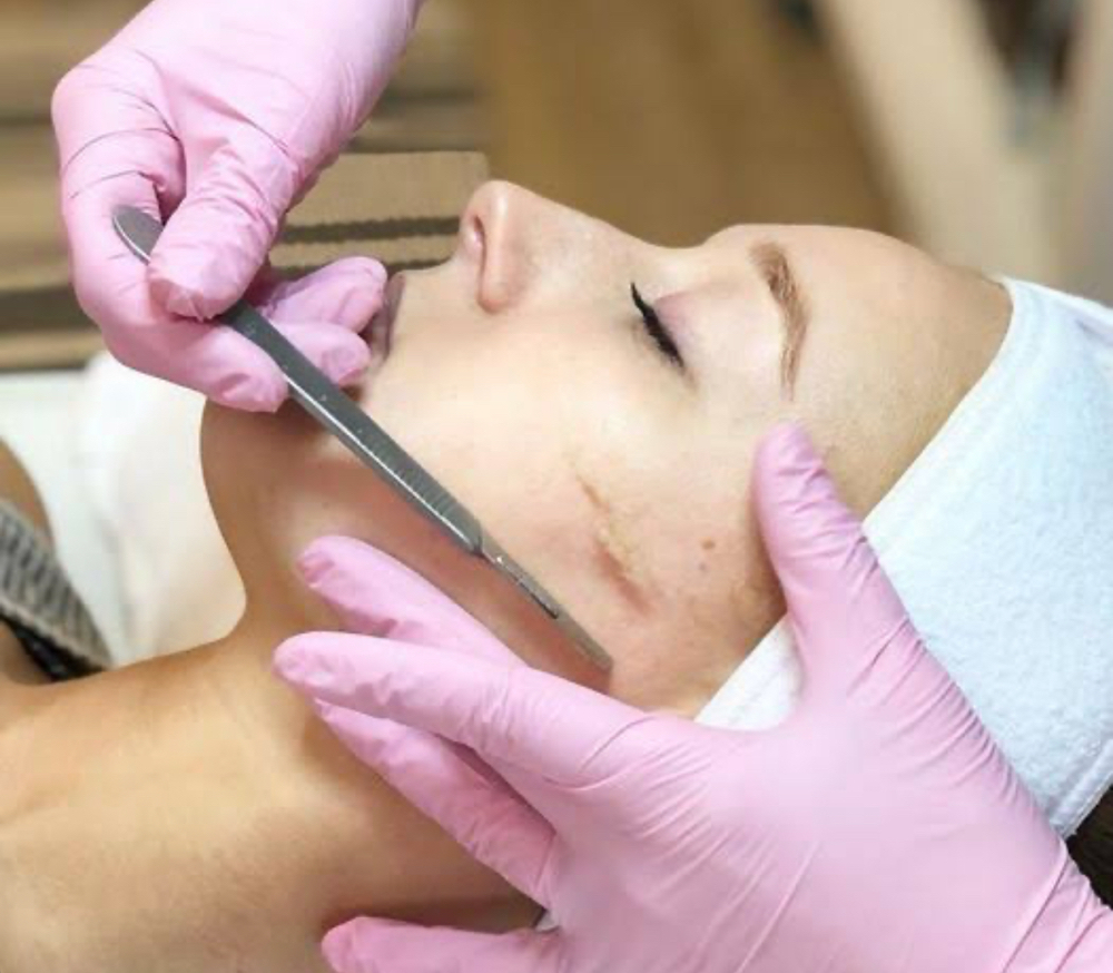 Dermaplaning