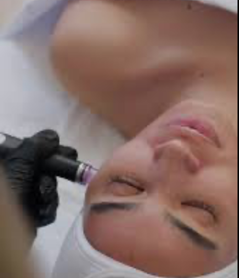 Hydra Facial Deluxe