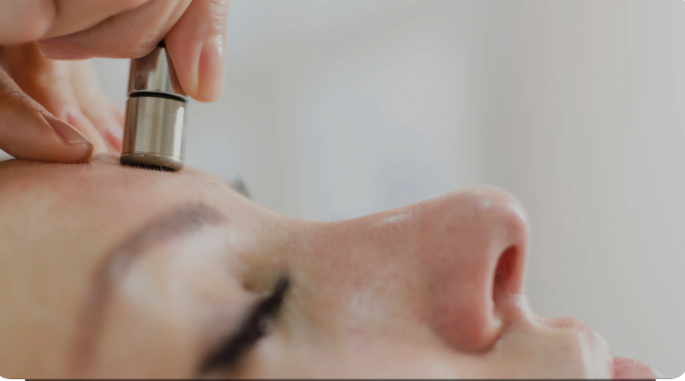 Microdermabrasion Facial