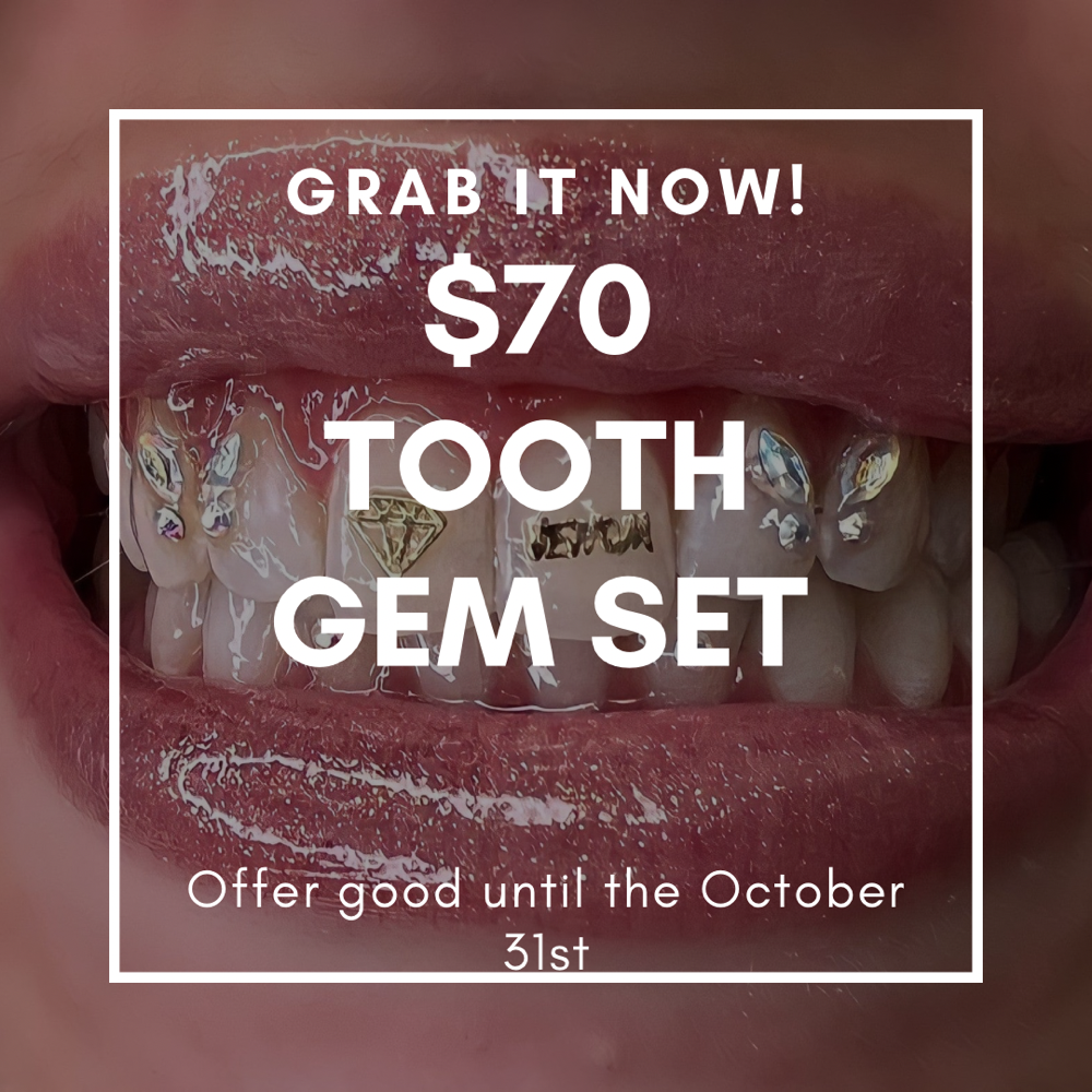 $70 Tooth Gems