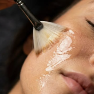 Chemical Peel Treatment at Nikki Blake Esthetics in Grand Rapids, MI