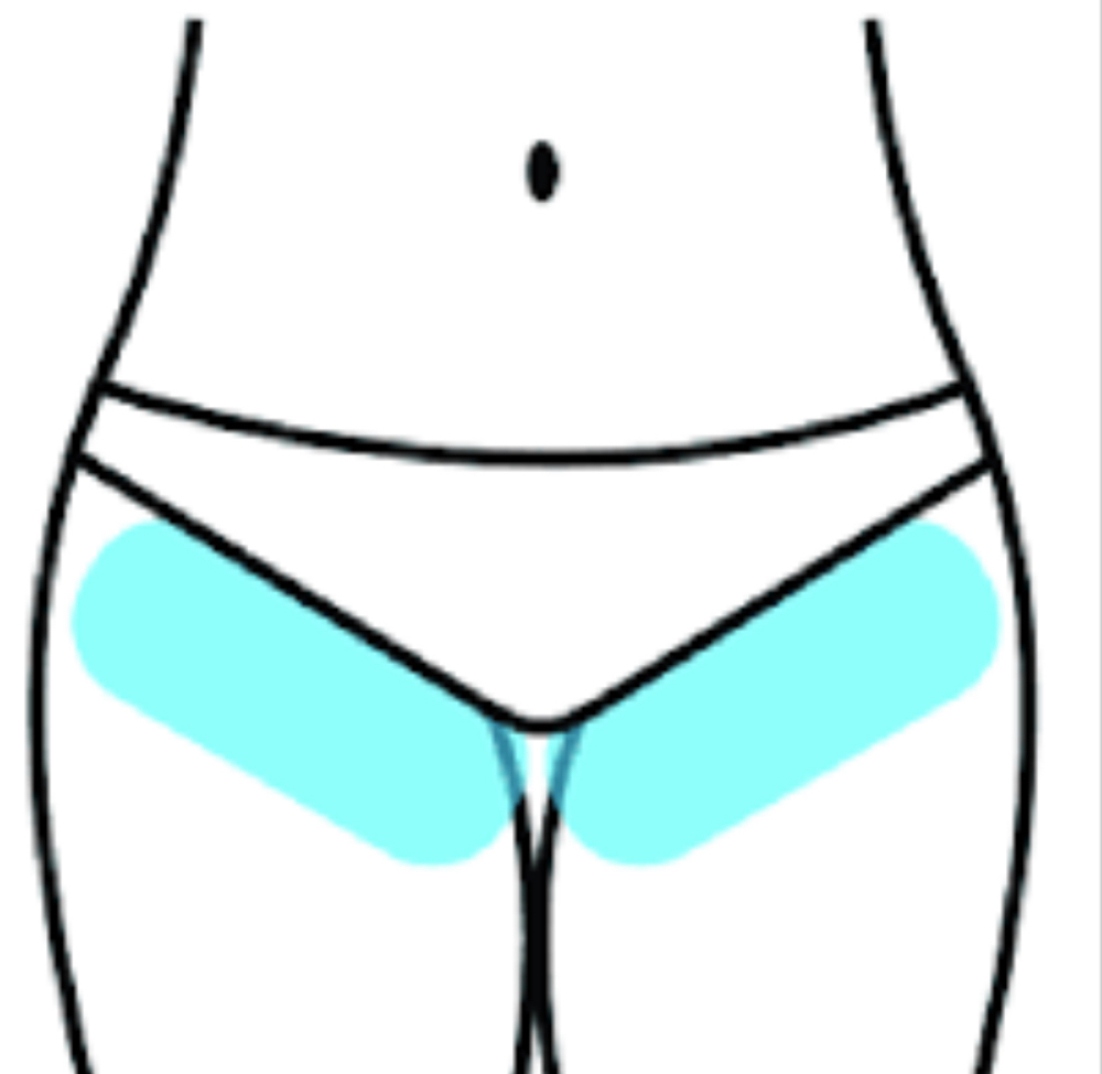 Bikini Line