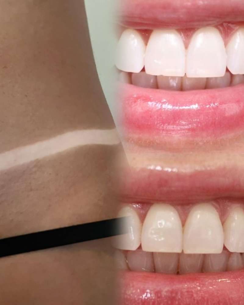 Spray Tanning + Teeth Whitening