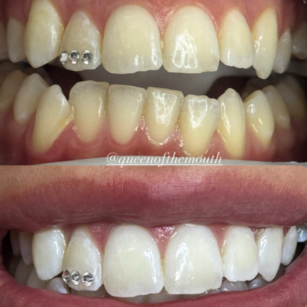 Bright White & freestyle Gems at Queen Of The Mouth in San Antonio, TX