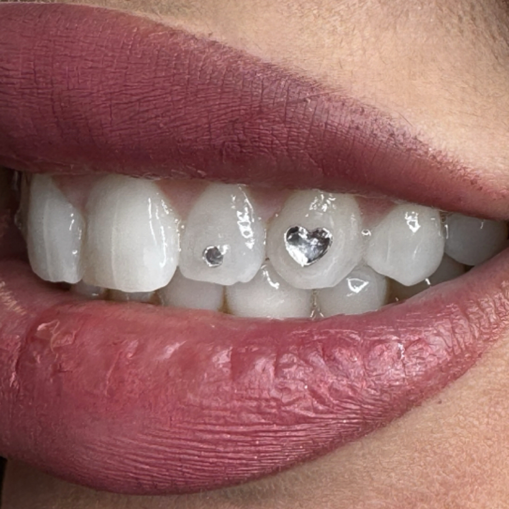 Bright White & freestyle Gems