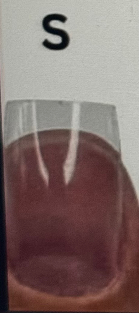Acrylic- Short
