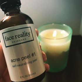 Acne Peel Treatment