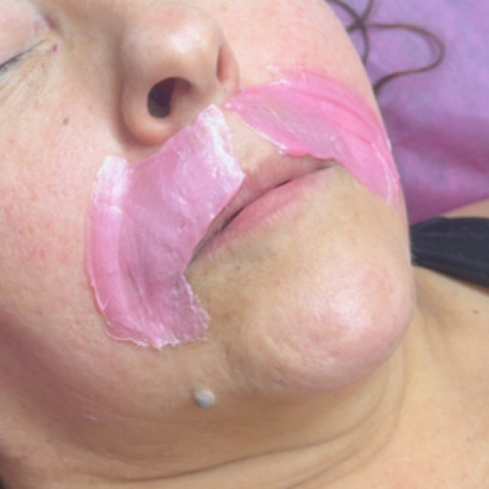 Upper Lip at FAB BARE SKIN STUDIO in Sacramento, CA