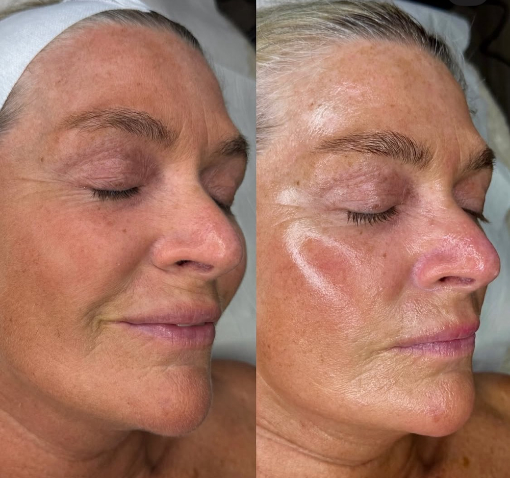 Radiant Glow  Facial