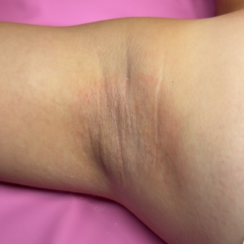 Underarm wax at Bae's Beauty Esthetics in Milan, TN