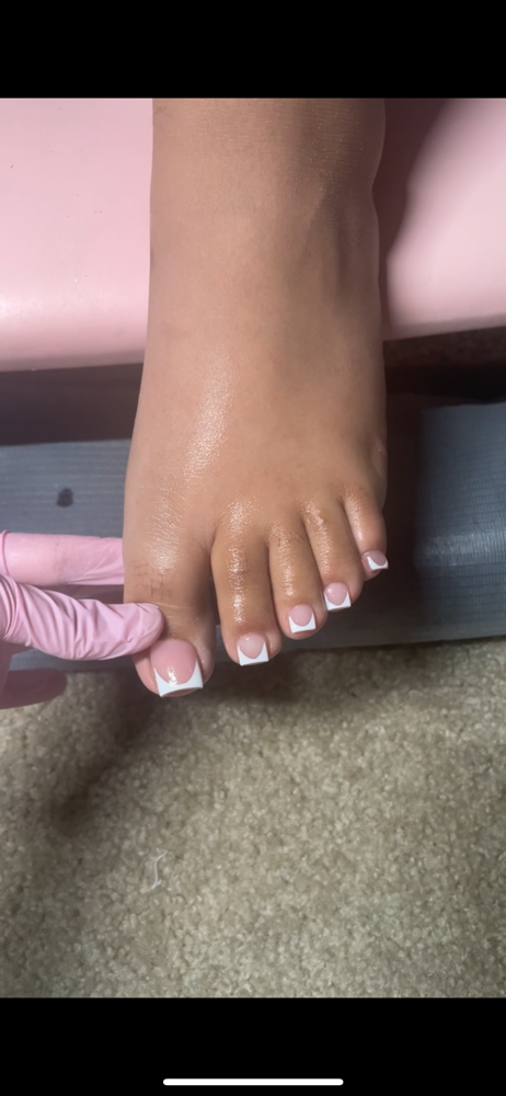 Acrylic toes