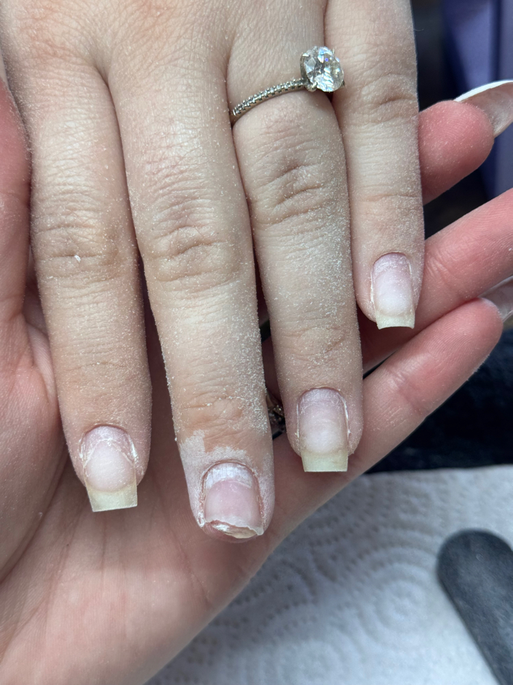 Nail Fix