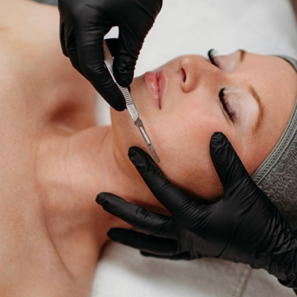 Dermaplane Add - On at Everglow Esthetics in Downey, CA