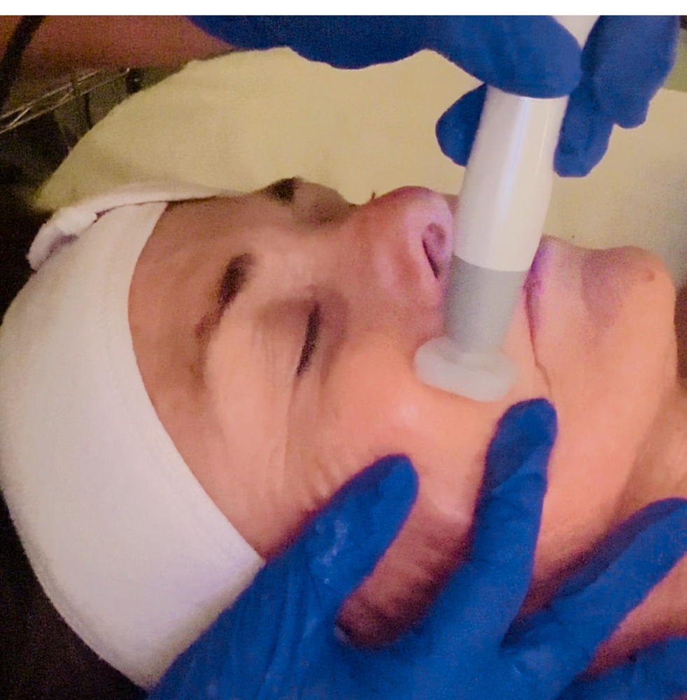 Jet Plasma Treatment