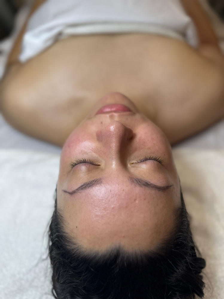 O2 Lift - Oxygen Dome Facial