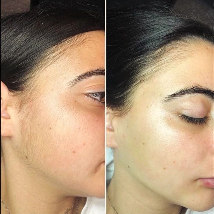 Face Wax at True Beauty LLC in Hobart, IN