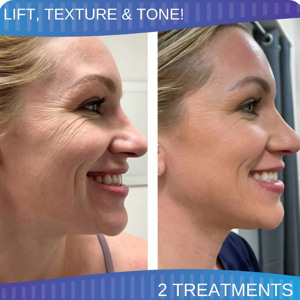 Procell Therapies Both Face & Neck