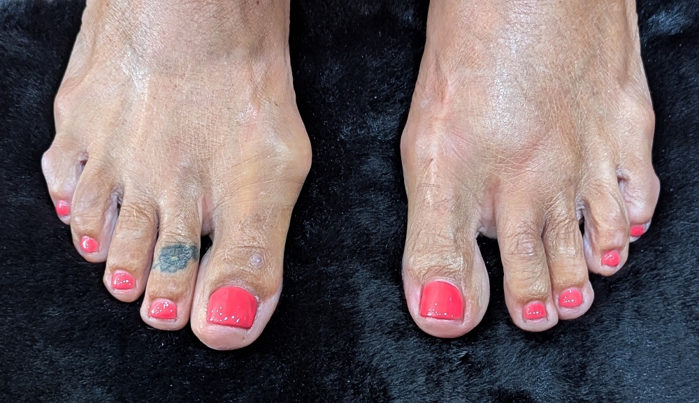 Pedicure
