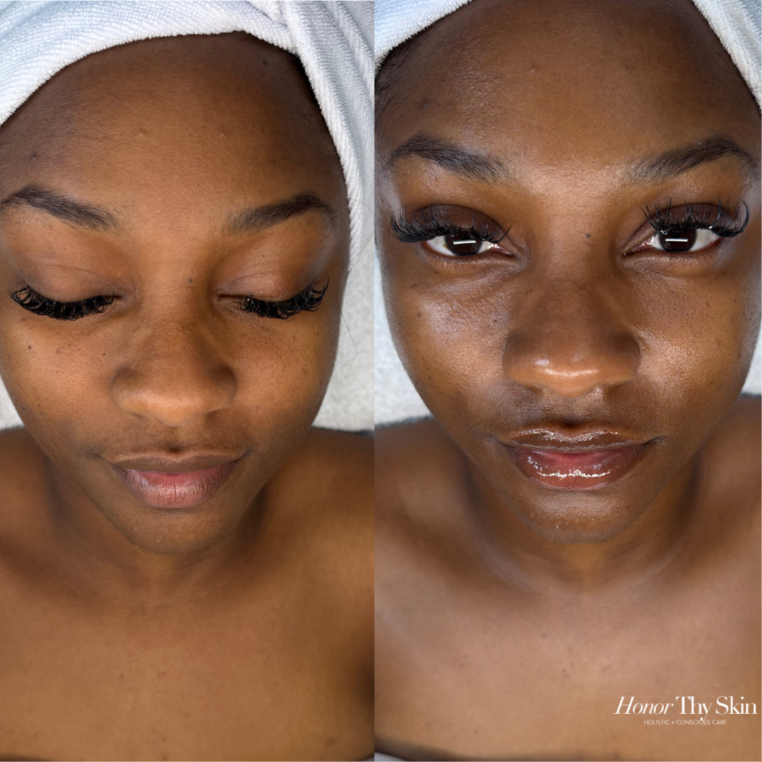 HonorThyslf Facial ~ Loyal Client at Honor Thy Skin in Charlotte, NC