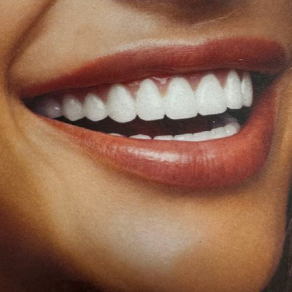 New Clients at Pearly Whites by Mal, LLC in Rock Hill, SC