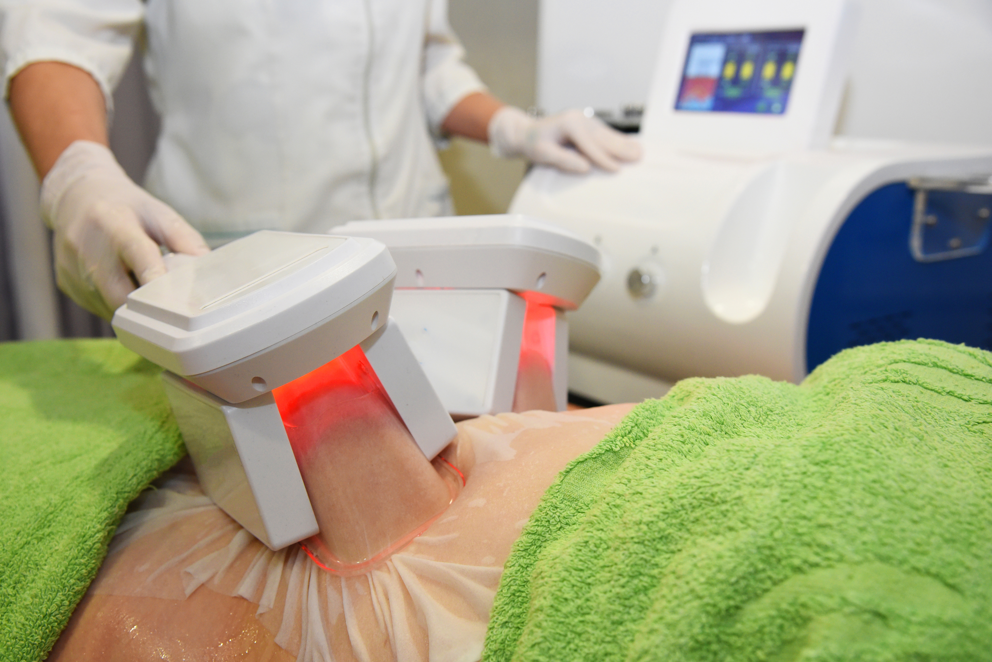 Cryolipolysis Fat Reduction