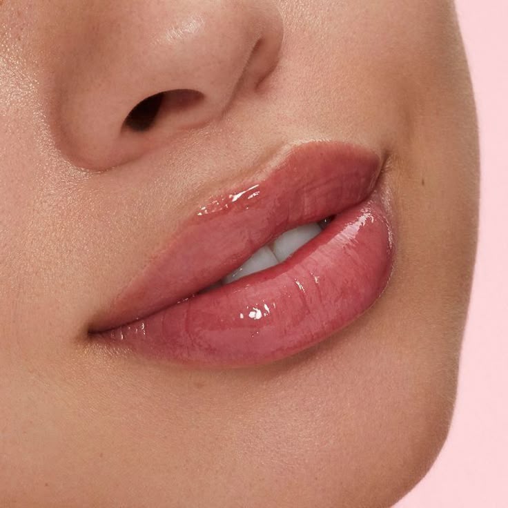 1 ML Needle-less Hyaluronic Acid