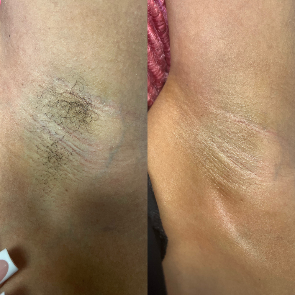 Underarm Wax at Too Flawless Esthetics in Memphis, TN