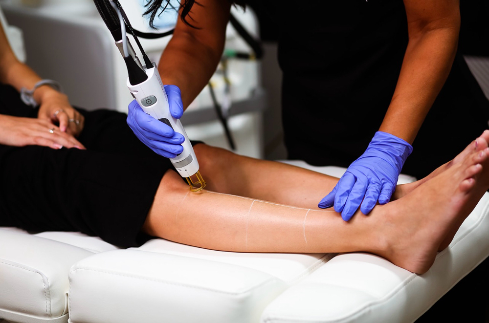 Laser Hair removal-large Area