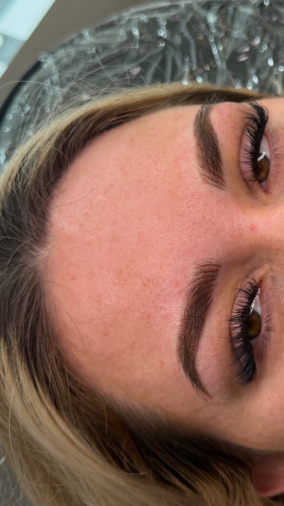 Lamination & Tint at Elements of Esthetics in Arlington, TX